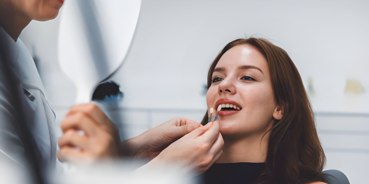 Brighten Your Smile with Professional Teeth Whitening Treatments in Epping